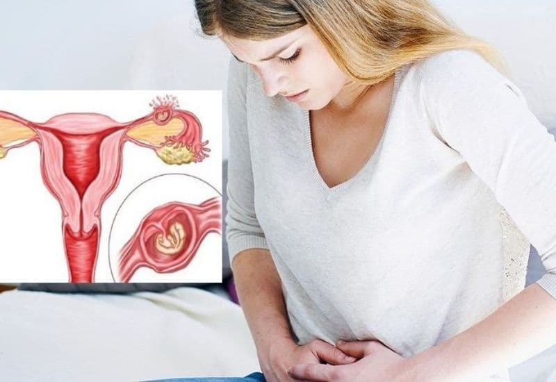 Mang thai ngoài tử cung là một tình trạng nguy hiểm đối với mẹ bầu.