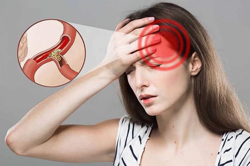 Nguyên nhân gây bệnh rối loạn tiền đình