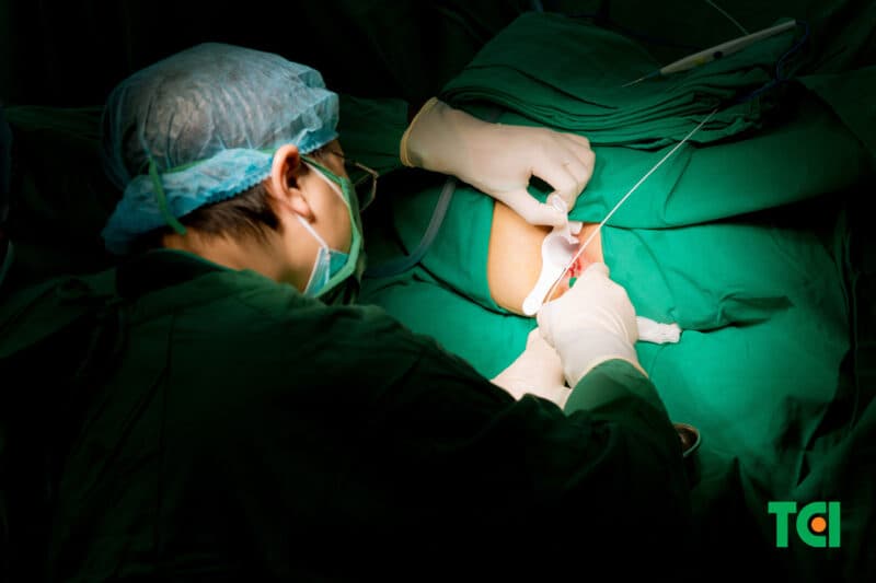 Thu Cúc TCI hiện đang đi đầu trong điều trị trĩ bằng phương pháp đốt trĩ Laser Diode