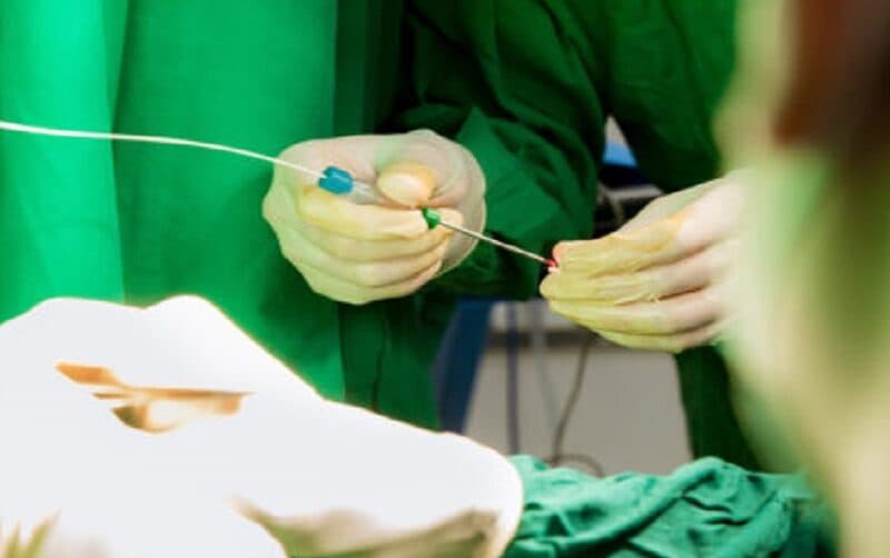 Đốt trĩ Laser Diode tại TCI