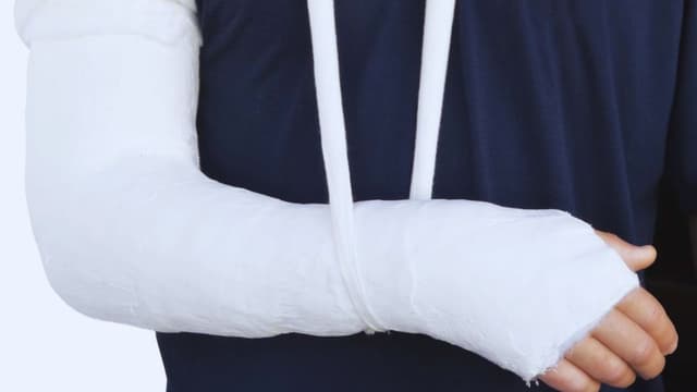 Cách sơ cứu khi bị gãy xương quay cẳng tay để tránh biến chứng