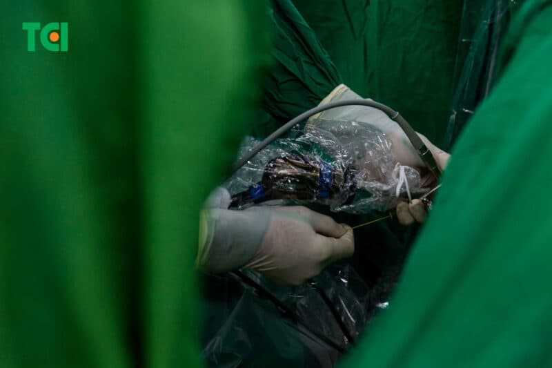 Phương pháp điều trị sỏi bàng quang