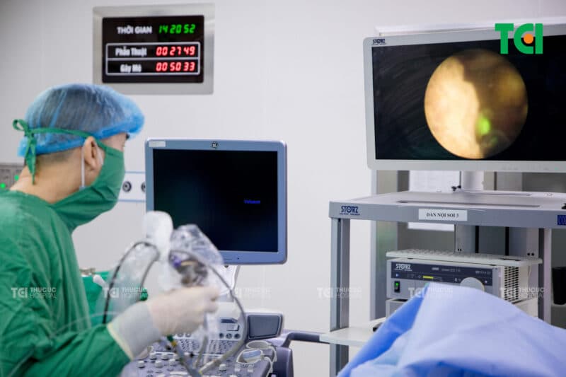 Tán sỏi công nghệ cao giúp giải quyết tắc nghẽn gây ứ nước thận nhanh chóng