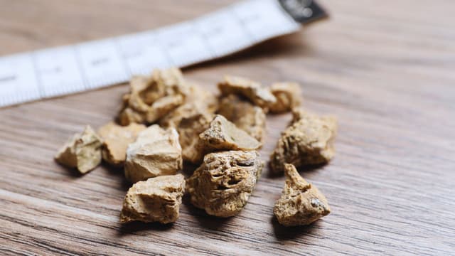 Tán sỏi tiết niệu xong có tái phát không và cách để phòng tránh