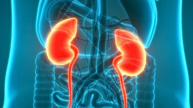 Thận trái ứ nước độ 1 và thận phải ứ nước độ 2 – Hướng điều trị