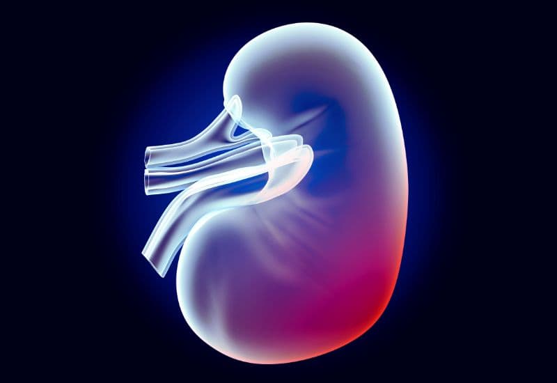 Nguyên nhân siêu âm bị thận ứ nước nhưng không đau