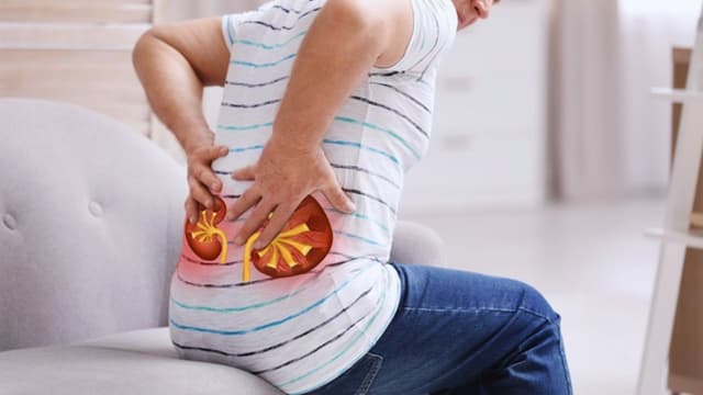 Mức độ nguy hiểm của thận ứ nước độ 2 và cách cải thiện