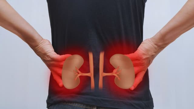 Thận ứ nước và suy thận: Mối liên hệ nguy hiểm!