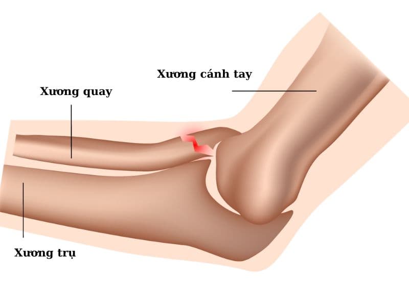 Xương quay cẳng tay là gì? Vị trí và vai trò trong cơ thể