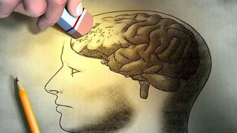 Alzheimer là gì và triệu chứng nhận diện bệnh