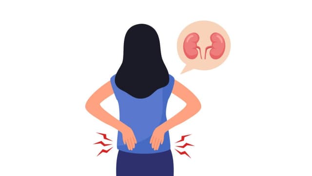 Cảnh giác đau lưng, tiểu ít có thể là dấu hiệu thận ứ nước độ 1