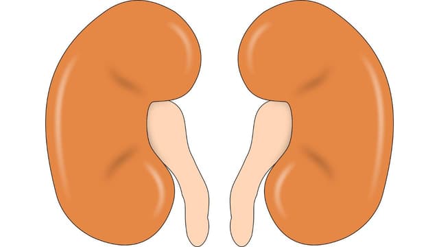 Vì sao bị đài bể thận giãn độ 3: Cơ chế và các yếu tố nguy cơ