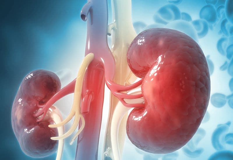 Đài bể thận giãn độ 3 là gì?