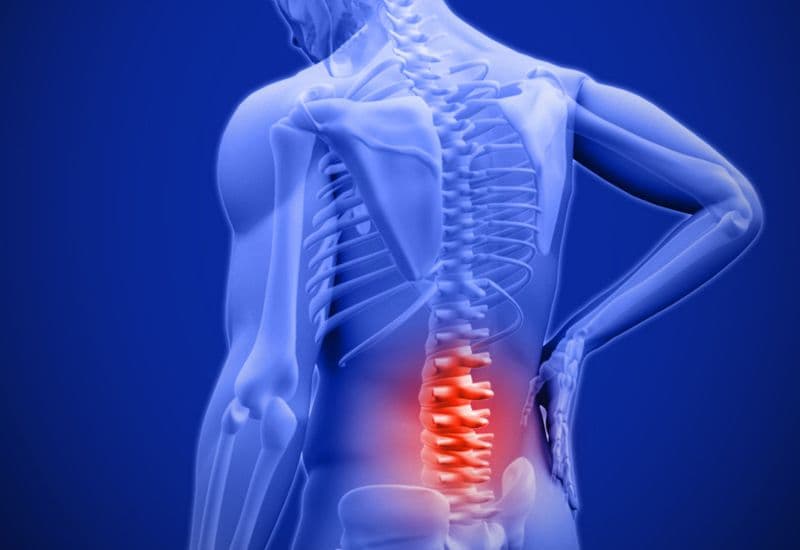 Phân biệt với đau lưng do bệnh cột sống và đau lựng ứ nước thận