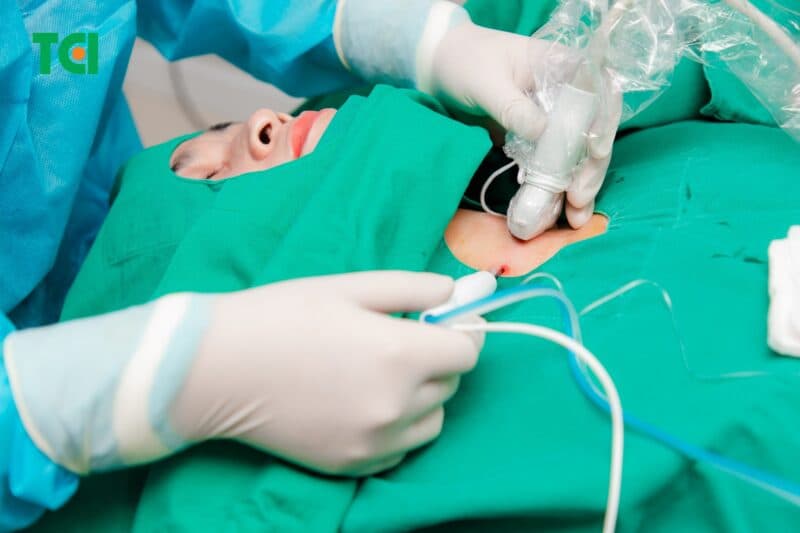 Can thiệp điều trị nhân tuyến giáp?