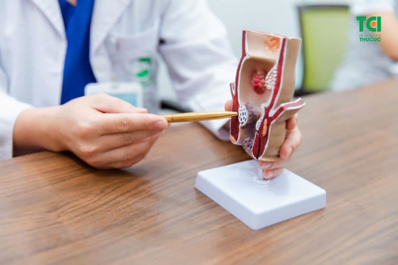 không ít người đứng trước câu hỏi lo lắng: mổ trĩ nội có đau không