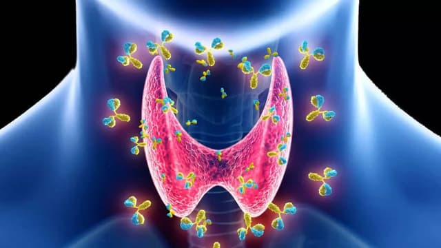 Nguyên nhân cường giáp và cách phòng tránh bệnh hiệu quả