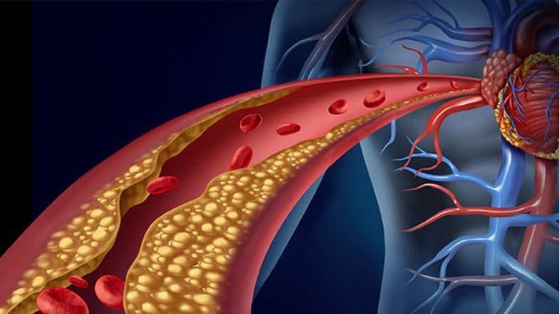 Nguyên nhân khiến nhịp tim rối loạn