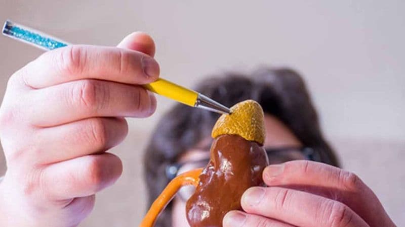 Suy tuyến thượng thận là bệnh gì?