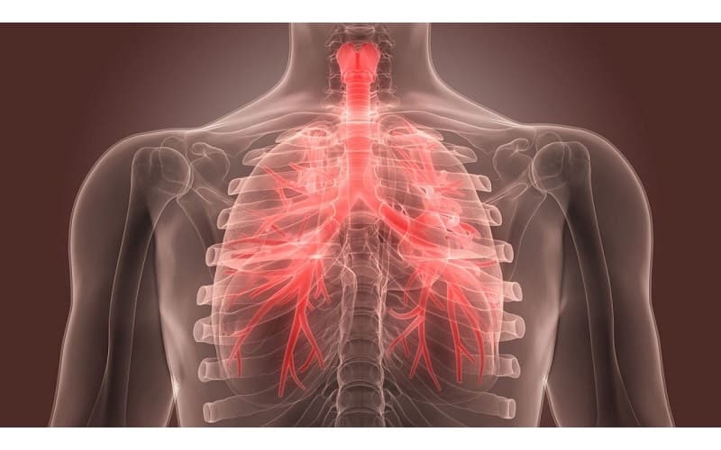 Viêm phế quản tiềm ẩn nhiều nguy hiểm 