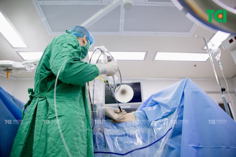 Nội soi tán sỏi thận qua da – giải pháp lý tưởng cho sỏi tái phát