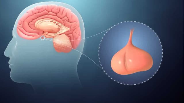 Các dạng rối loạn tuyến yên và cách chẩn đoán, điều trị