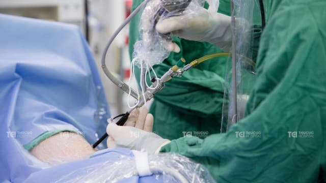 Tán sỏi thận qua da: Kỹ thuật tiên tiến loại bỏ sỏi lớn