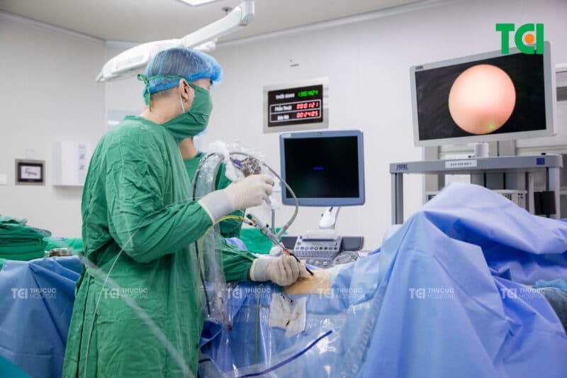 Tán sỏi thận qua da là gì và khi nào cần thực hiện?