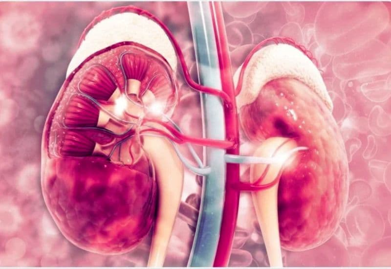 Giãn đài bể thận là gì và vì sao cần xác định nguyên nhân?