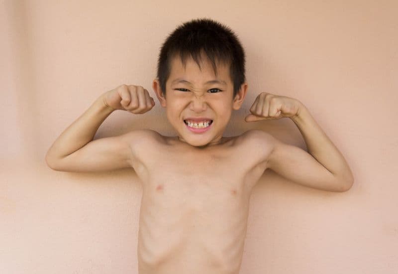 Bé còi xương là một tình trạng thường gặp ở trẻ nhỏ hiện nay.