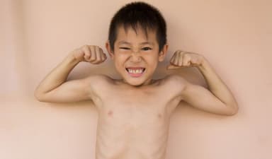 5 lý do khiến bé còi xương và cách phòng tránh hiệu quả