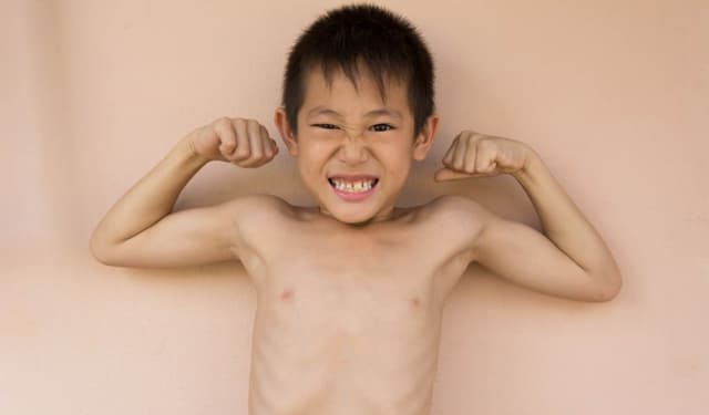 5 lý do khiến bé còi xương và cách phòng tránh hiệu quả