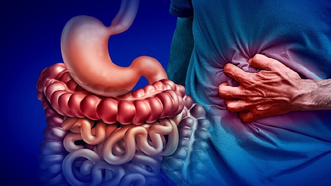 Bệnh lý Crohn đặc trưng bởi tình trạng viêm lan sâu vào các lớp mô của đường tiêu hóa