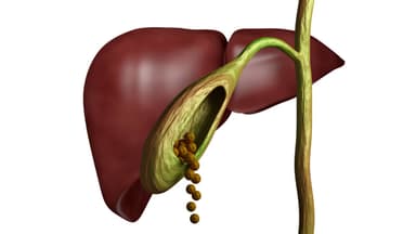 Sỏi túi mật: Những thông tin cơ bản ai cũng nên biết