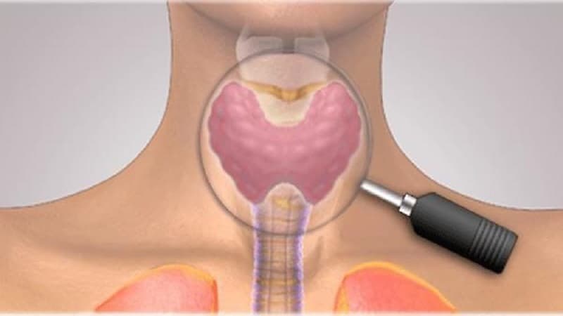 Viêm tuyến giáp là một trong những vấn đề nội tiết khá phổ biến