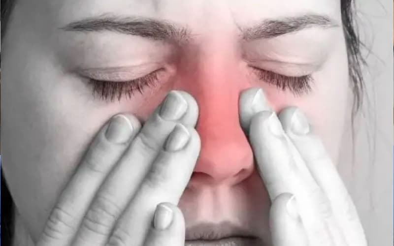 lý do bị viêm xoang