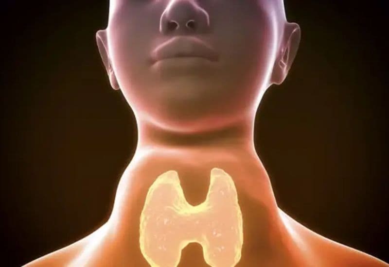 Bướu giáp Basedow là bệnh gì?
