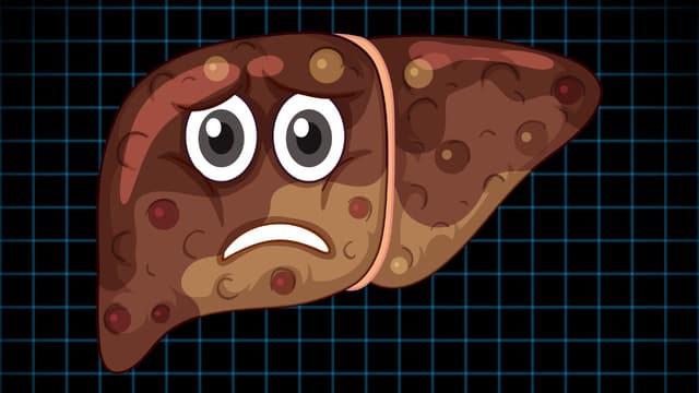 Tìm hiểu cách trị bệnh gan nhiễm mỡ hiệu quả