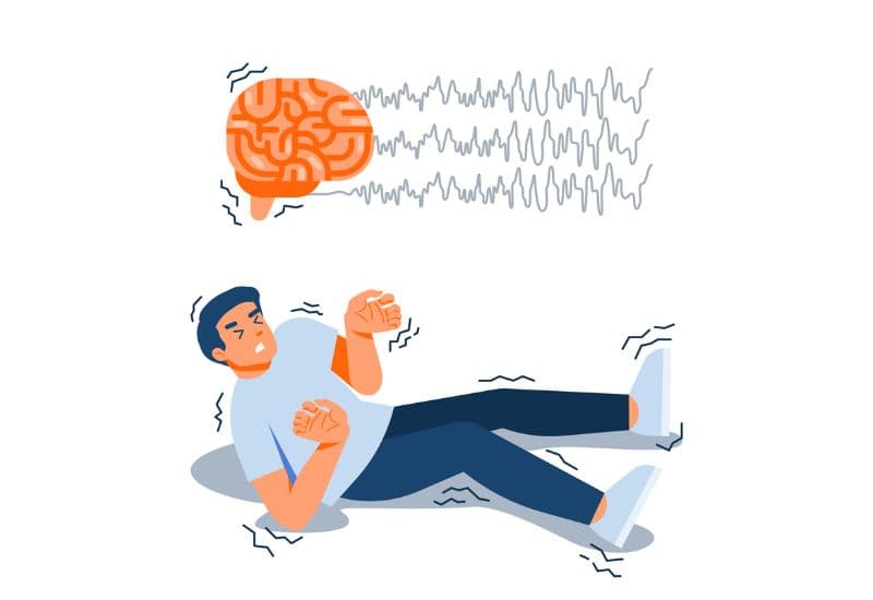 Co giật động kinh là gì