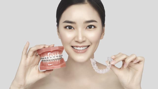 Có nên niềng răng không &#8211; Những điều bạn nên biết