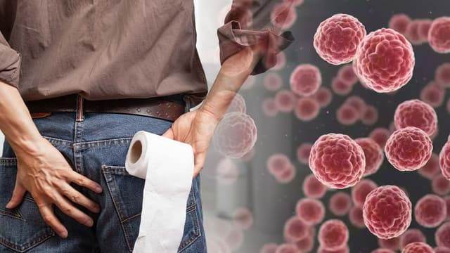 Nổi cục thịt ở gần hậu môn và dấu hiệu cảnh báo sức khỏe