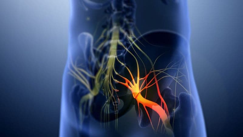 Triệu chứng đau dây thần kinh tọa ảnh hưởng như thế nào đến cuộc sống của người bệnh