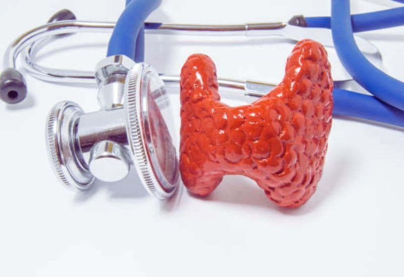 Cách điều trị hiệu quả bướu giáp Basedow