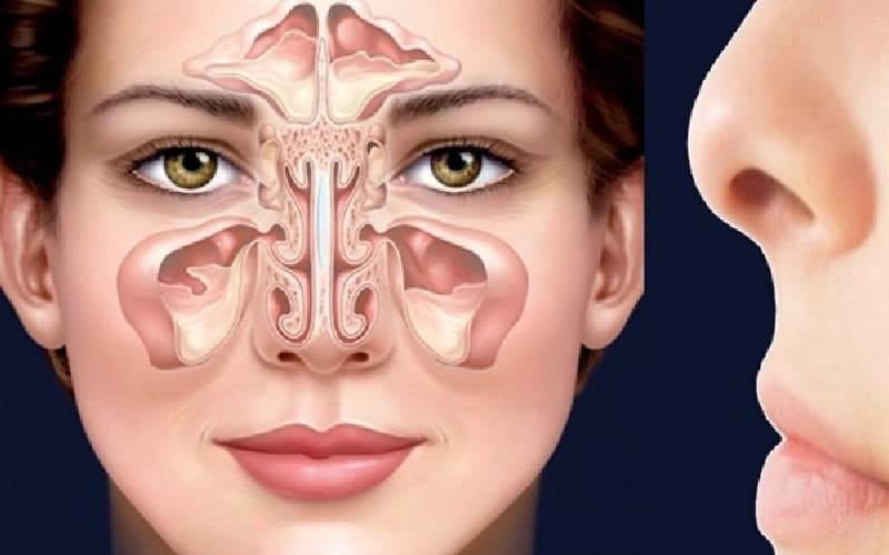 Cách Điều trị xoang