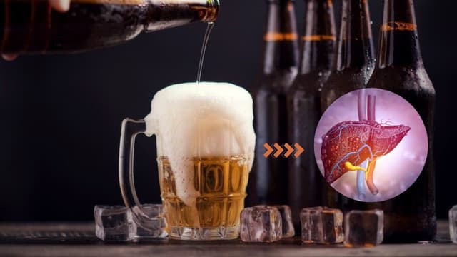 Gan nhiễm mỡ kiêng gì, bí quyết bảo vệ sức khỏe