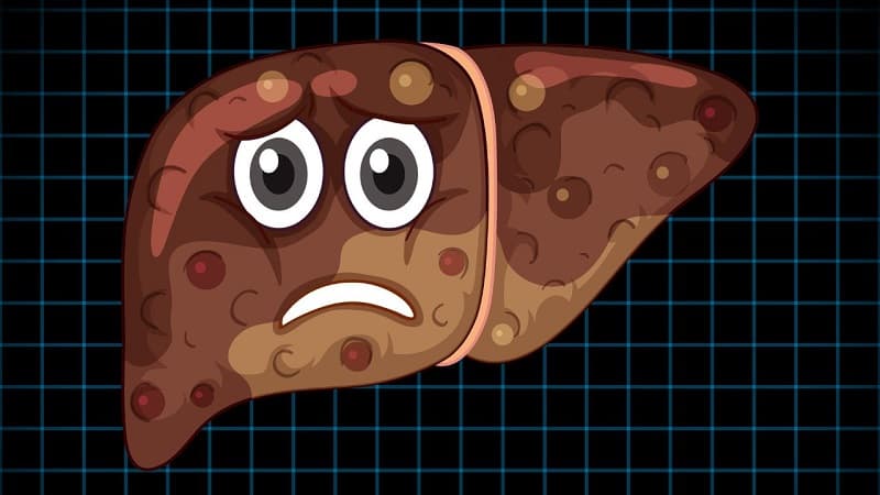 Gan nhiễm mỡ và cách trị bệnh