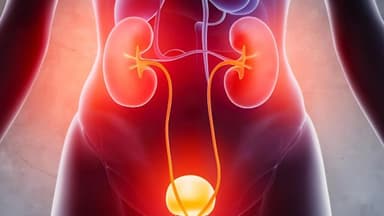 Hậu quả của giãn đài bể thận – Những biến chứng cần biết