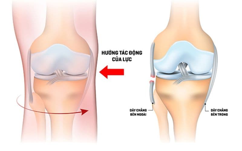 hệ thống dây chằng khớp gối