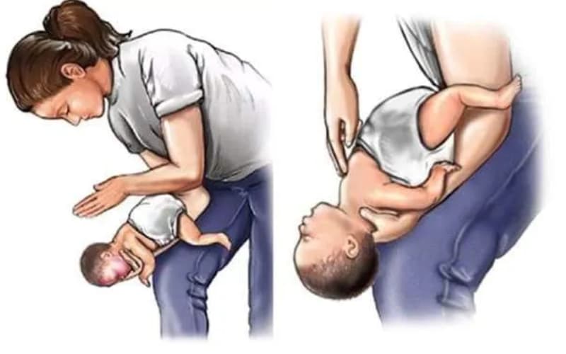 khi bị hóc dị vật nên làm gì với trẻ nhỏ