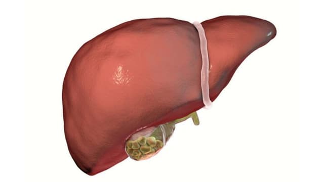Nhận biết nguyên nhân sỏi mật để chủ động phòng tránh sớm